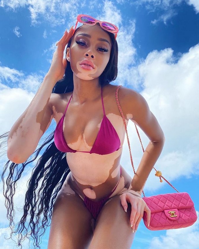 winnie-harlow-sexy-bikini-thefappening-cfd-4-1 Winnie Harlow Bikini