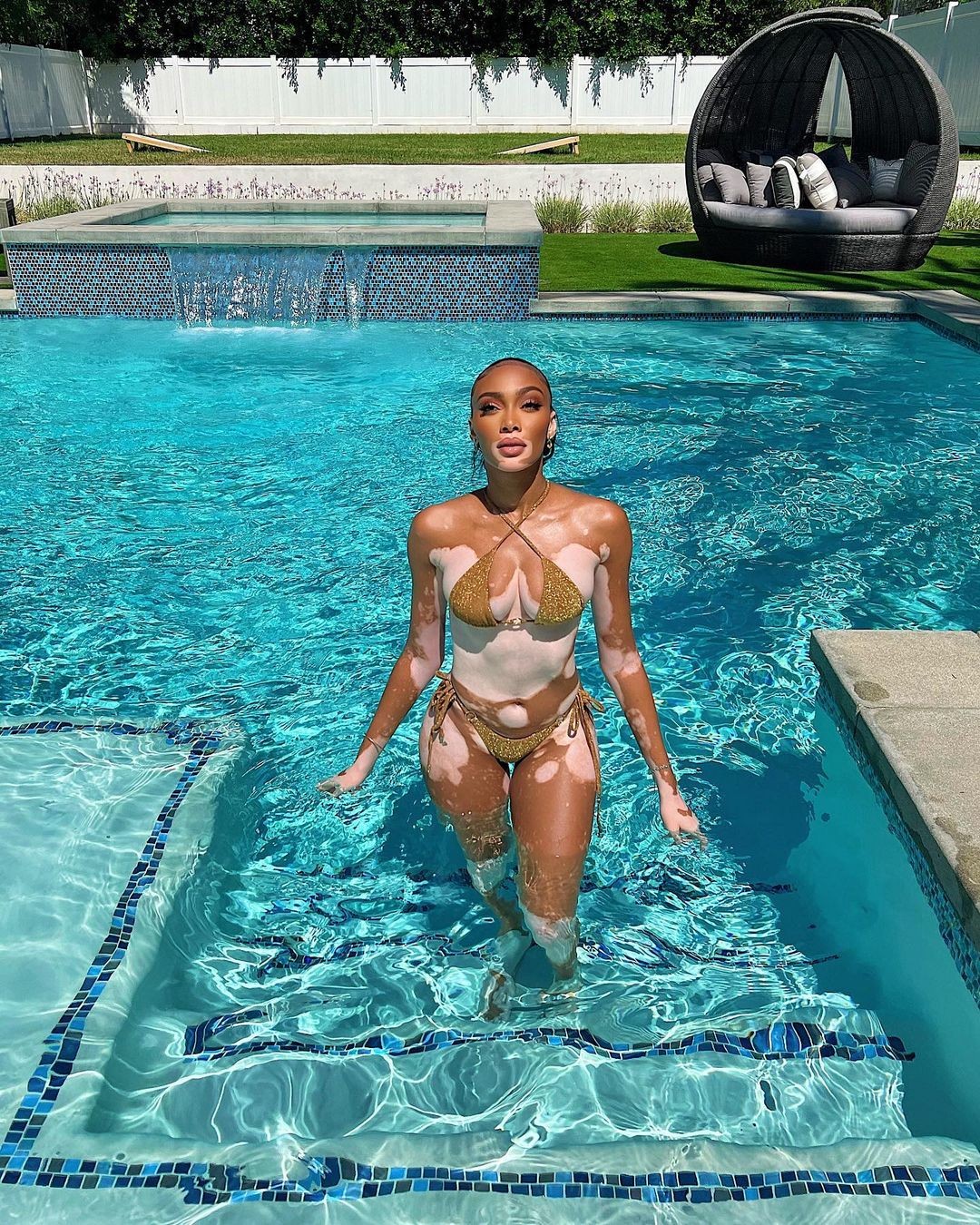 winnie-harlow-sexy-bikini-thefappening-cfd-4 winnie harlow sexy bikini thefappening cfd 4