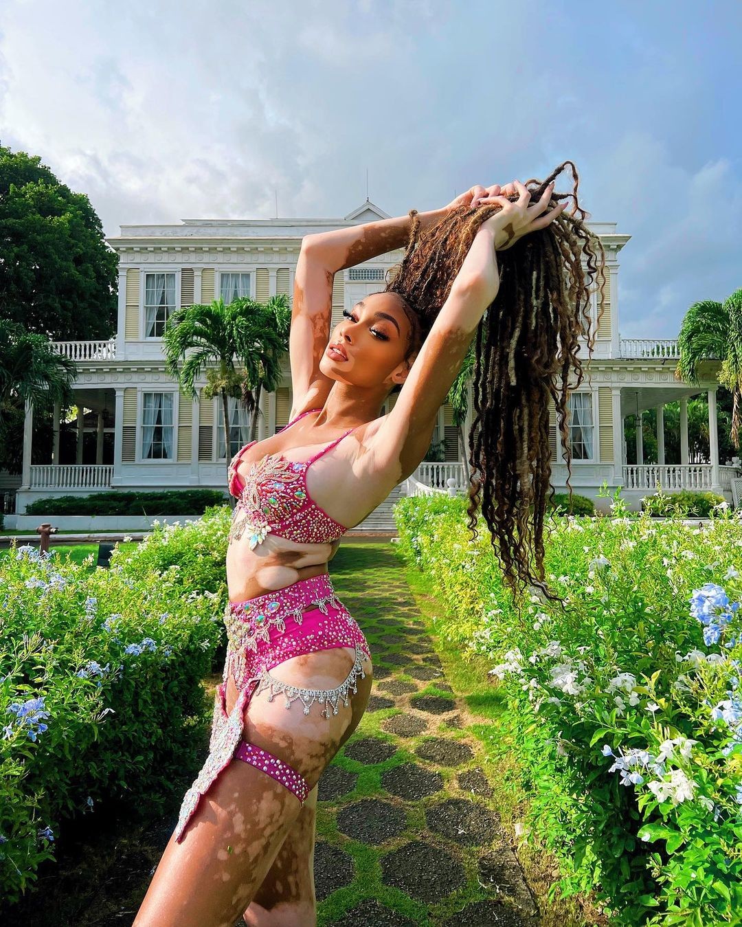 winnie-harlow-sexy-bikini-thefappening-cfd-9 winnie harlow sexy bikini thefappening cfd 9