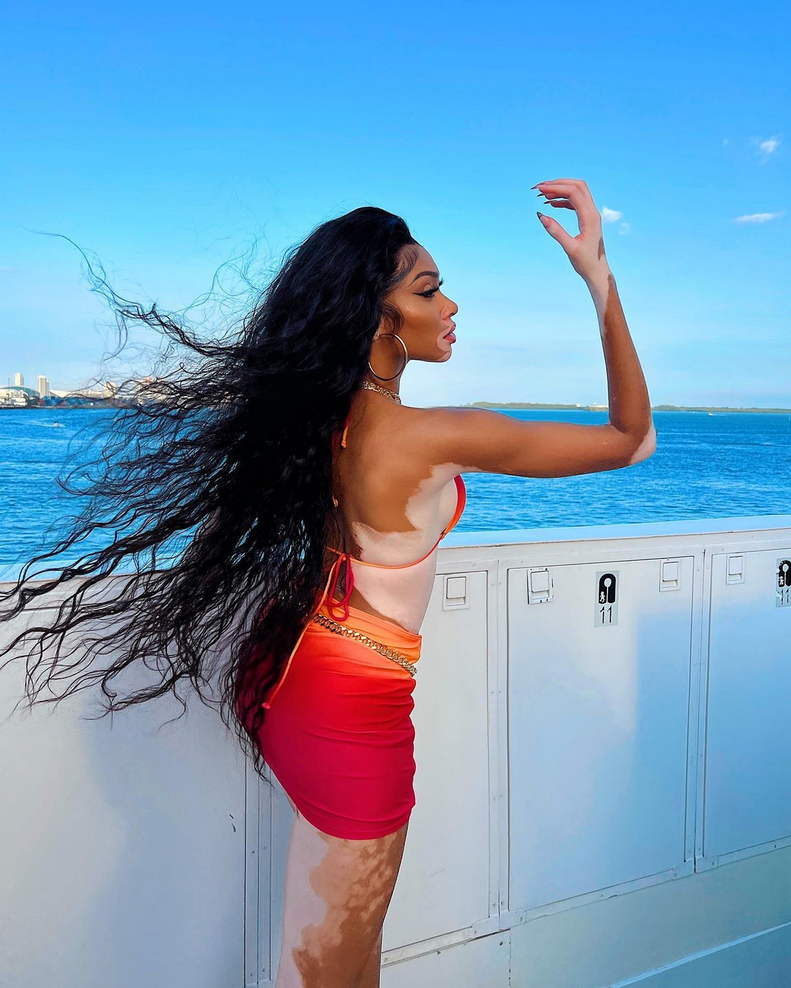 winnie-harlow-sexy-bikini-thefappening-pro-1 Winnie Harlow