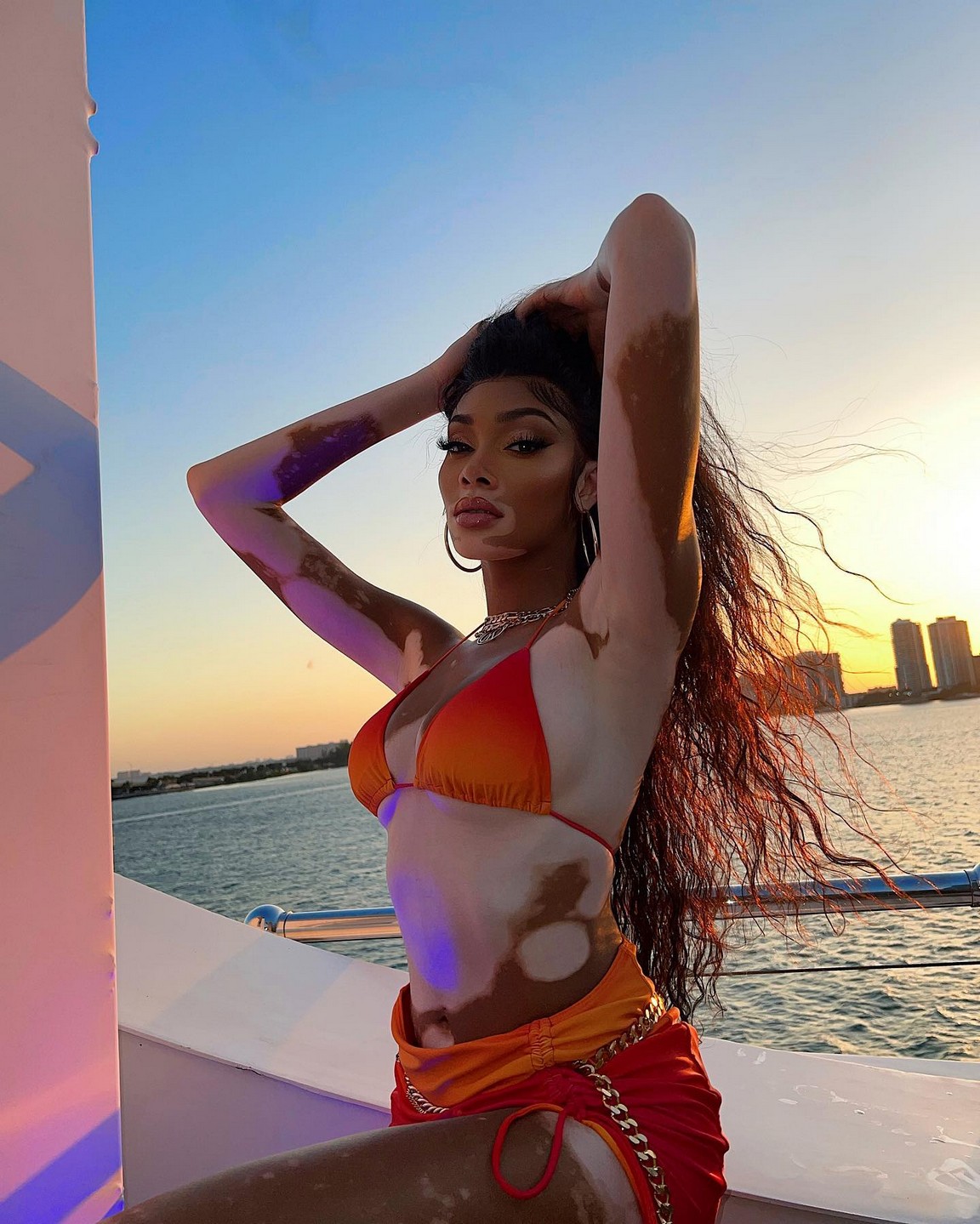 winnie-harlow-sexy-bikini-thefappening-pro-18 winnie harlow sexy bikini thefappening pro 18