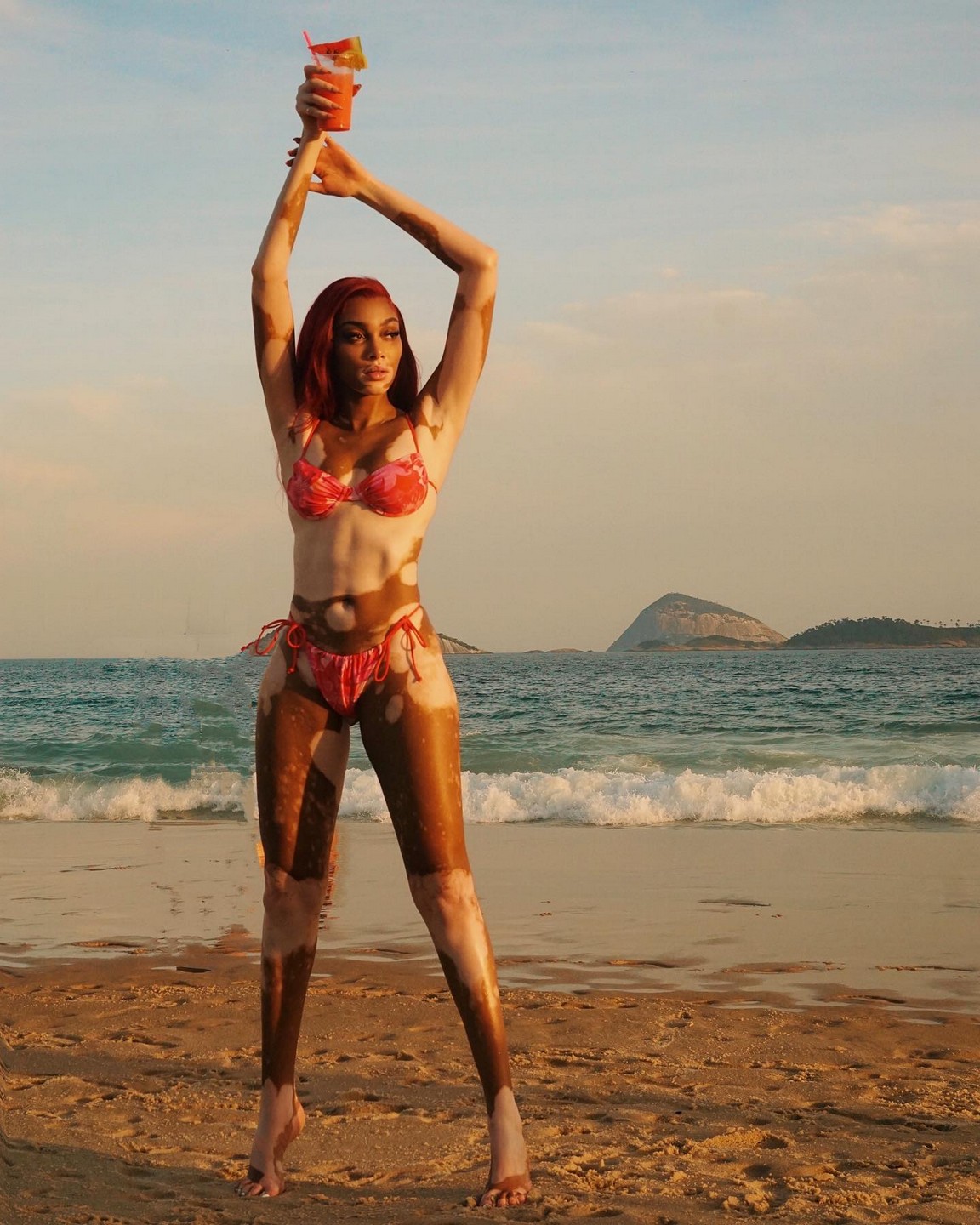winnie-harlow-sexy-bikini-thefappening-pro-7 Winnie Harlow Bikini