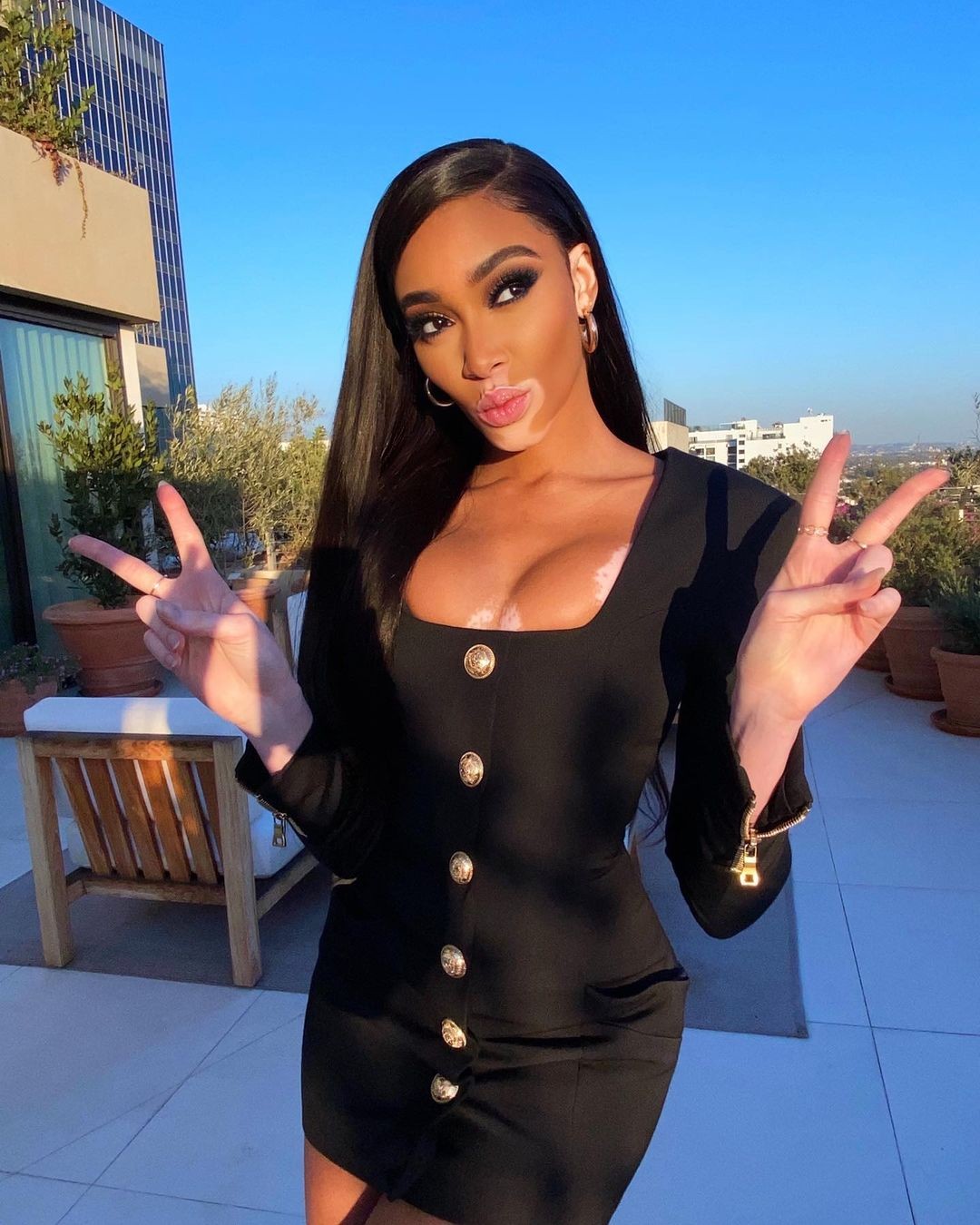 winnie-harlow-sexy-in-tiny-black-dress-thefappening-cfd-1 Winnie Harlow Sexy
