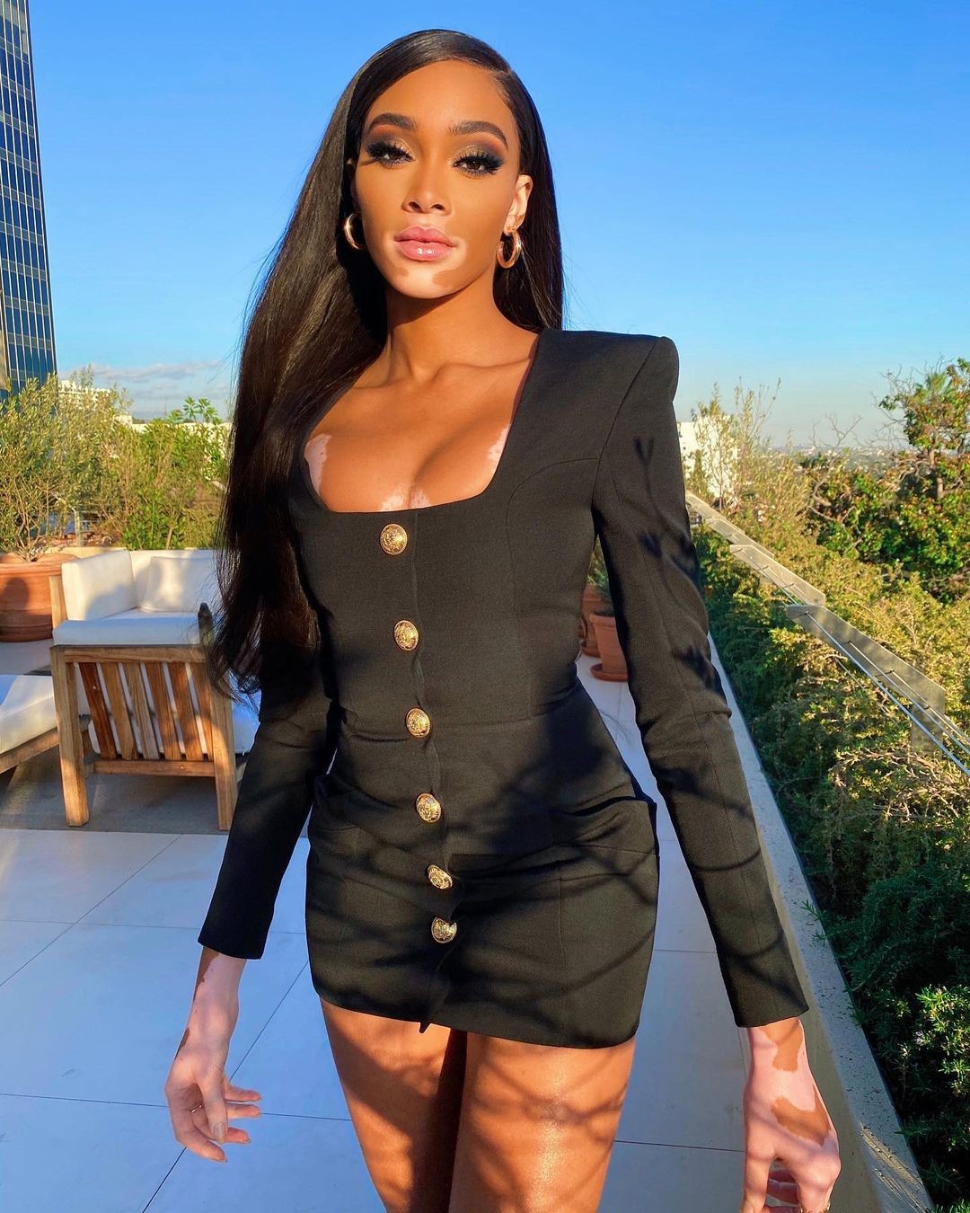 winnie-harlow-sexy-in-tiny-black-dress-thefappening-cfd-8-1 Winnie Harlow Sexy In Tiny Black Dress