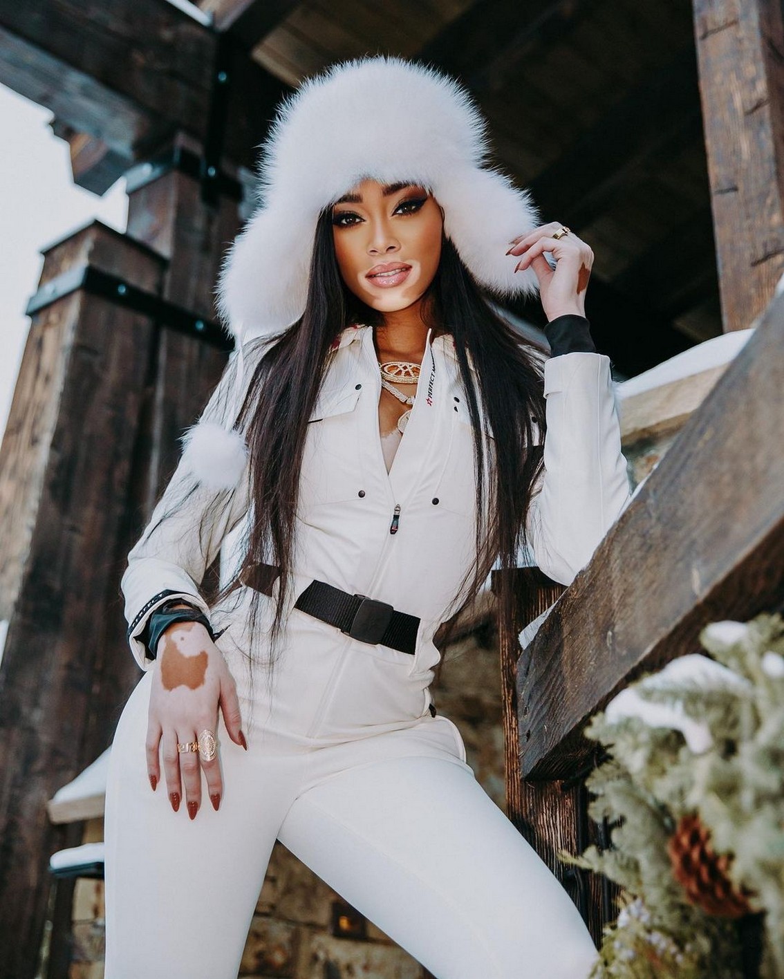 winnie-harlow-sexy-ski-resort-thefappening-cfd-12 winnie harlow sexy ski resort thefappening cfd 12
