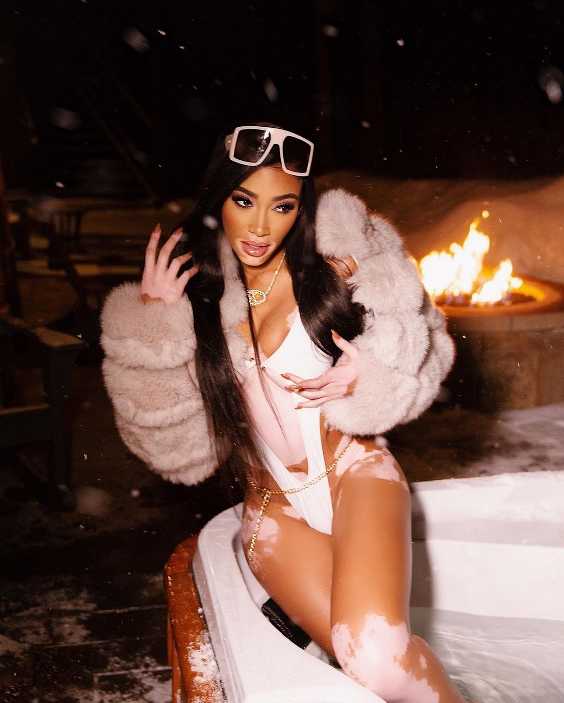 winnie-harlow-sexy-ski-resort-thefappening-cfd-21-1 Winnie Harlow Bikini At Ski Resort