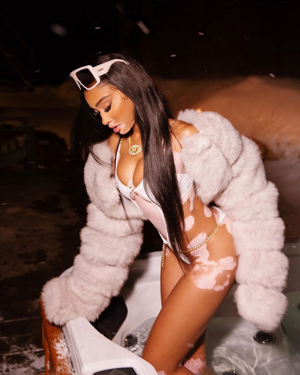 winnie-harlow-sexy-ski-resort-thefappening-cfd-22 Winnie Harlow Sexy In Snow Bath