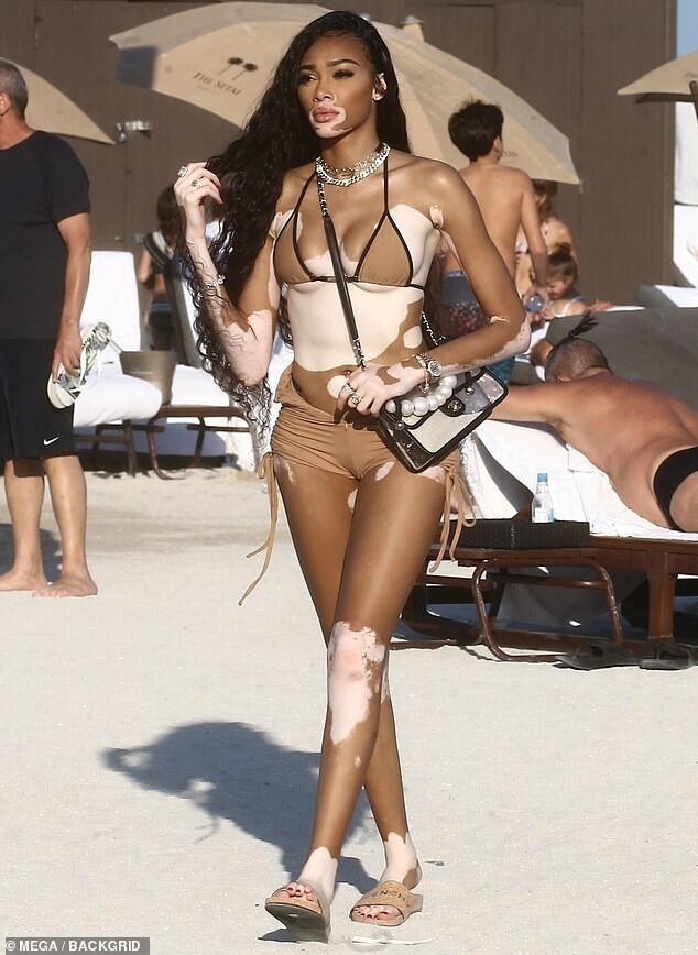 winnie-harlow-sexy-thefappening-cfd-2 Winnie Harlow Selfie