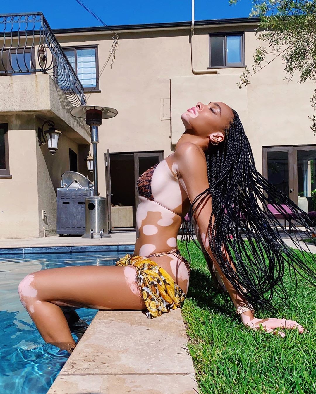 winnie-harlow-sexy-tiny-bikini-thefappening-pro-1 winnie harlow sexy tiny bikini thefappening pro 1