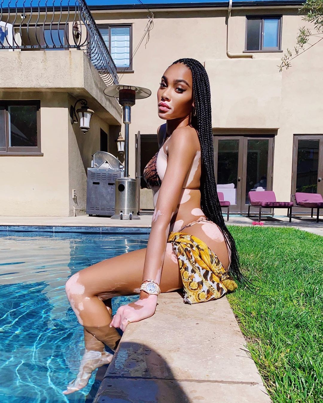winnie-harlow-sexy-tiny-bikini-thefappening-pro-3 Winnie Harlow Bikini