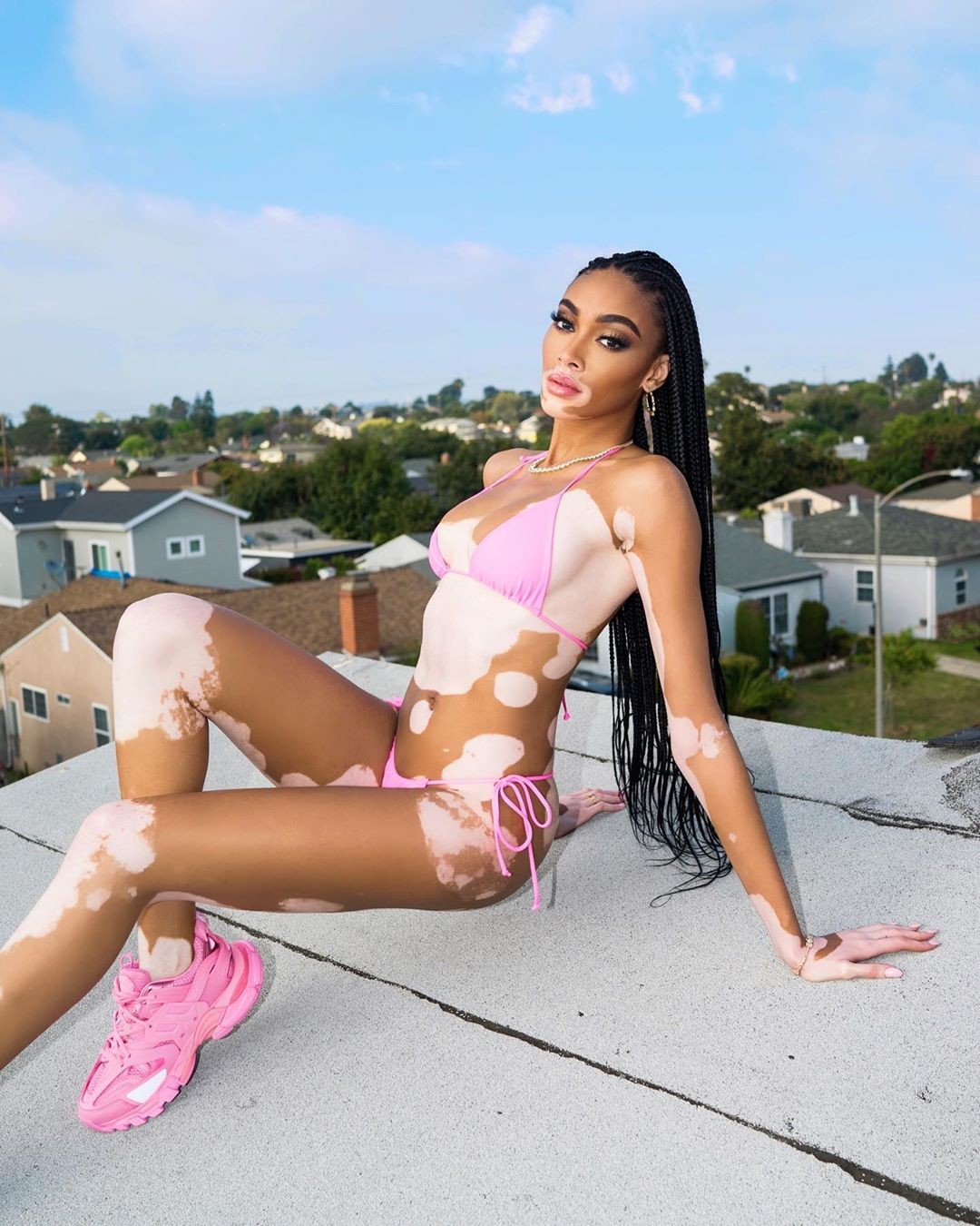 winnie-harlow-sexy-tiny-bikini-thefappening-pro-6 winnie harlow sexy tiny bikini thefappening pro 6