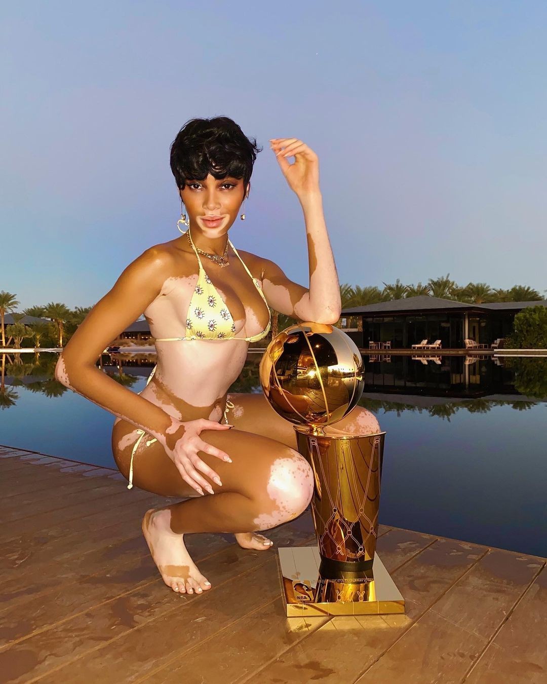 winnie-harlow-sexy-with-kyle-kuzma-thefappening-cfd-1 Winnie Harlow Sexy With Short Hair