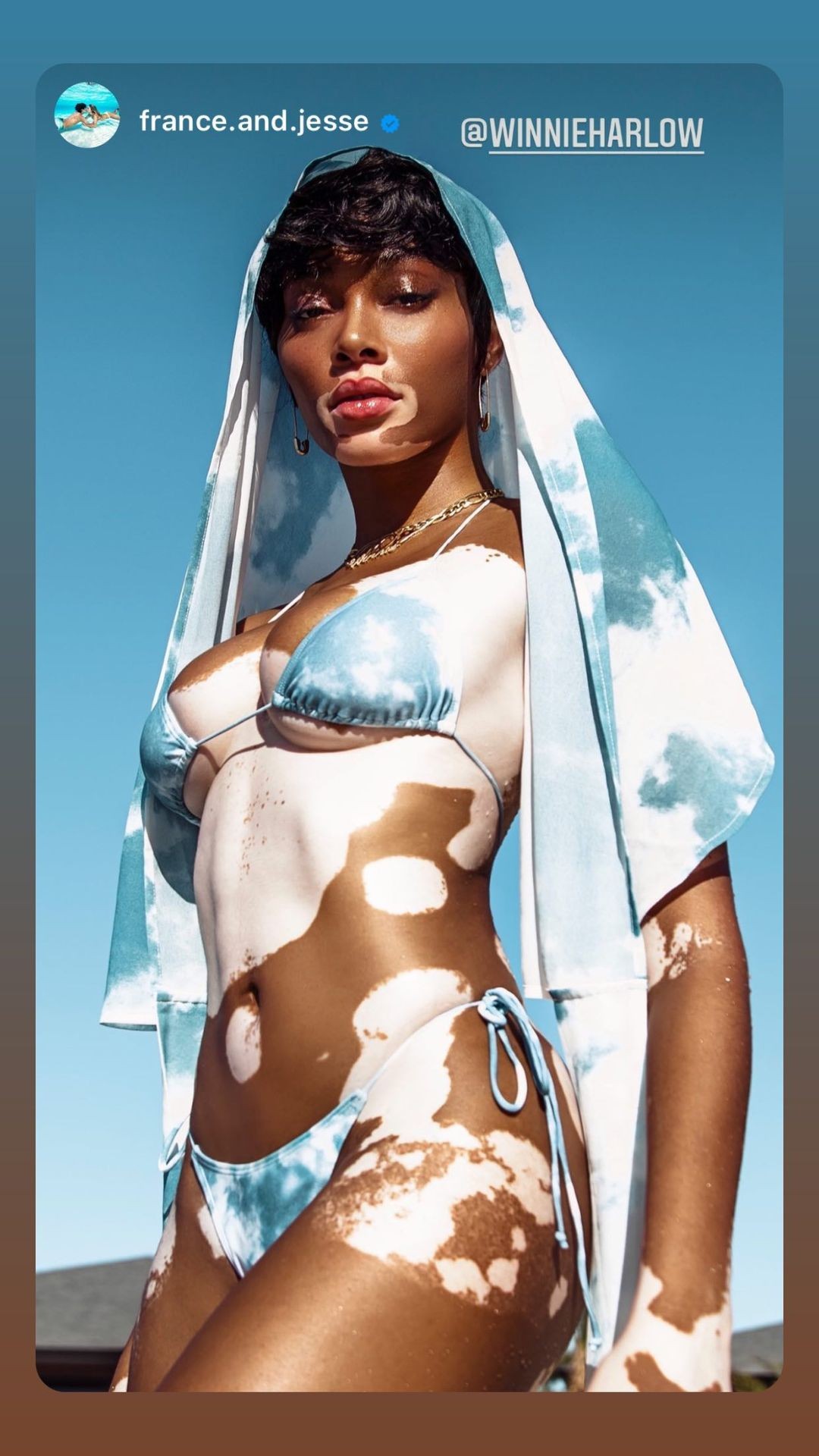 winnie-harlow-sexy-with-kyle-kuzma-thefappening-cfd-7 Winnie Harlow Sexy