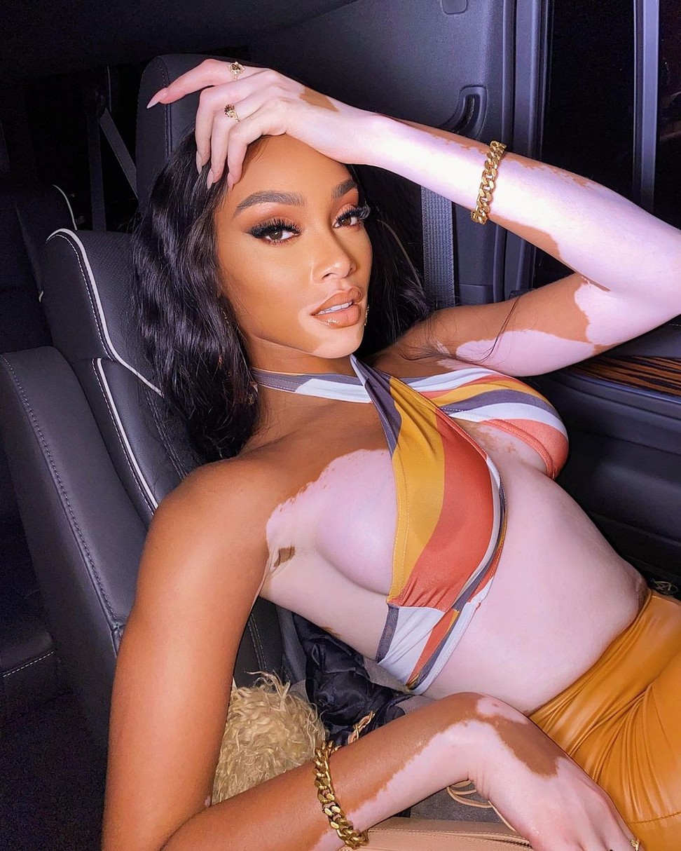 winnie-harlow-show-her-tits-braless-at-818-tequilla-party-thefappening-cfd-1 Winnie Harlow Braless