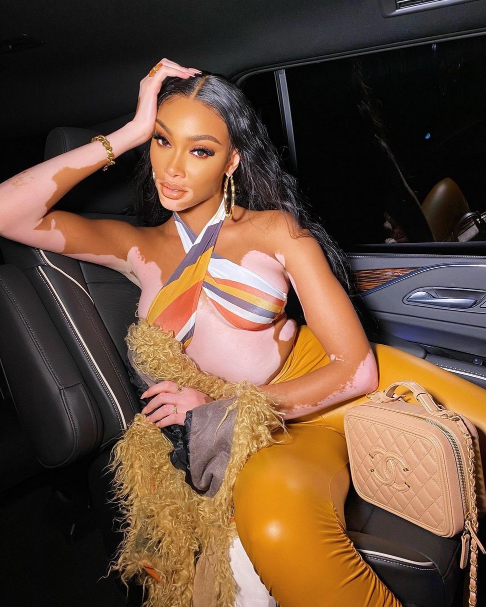 winnie-harlow-show-her-tits-braless-at-818-tequilla-party-thefappening-cfd-2 winnie harlow show her tits braless at 818 tequilla party thefappening cfd 2