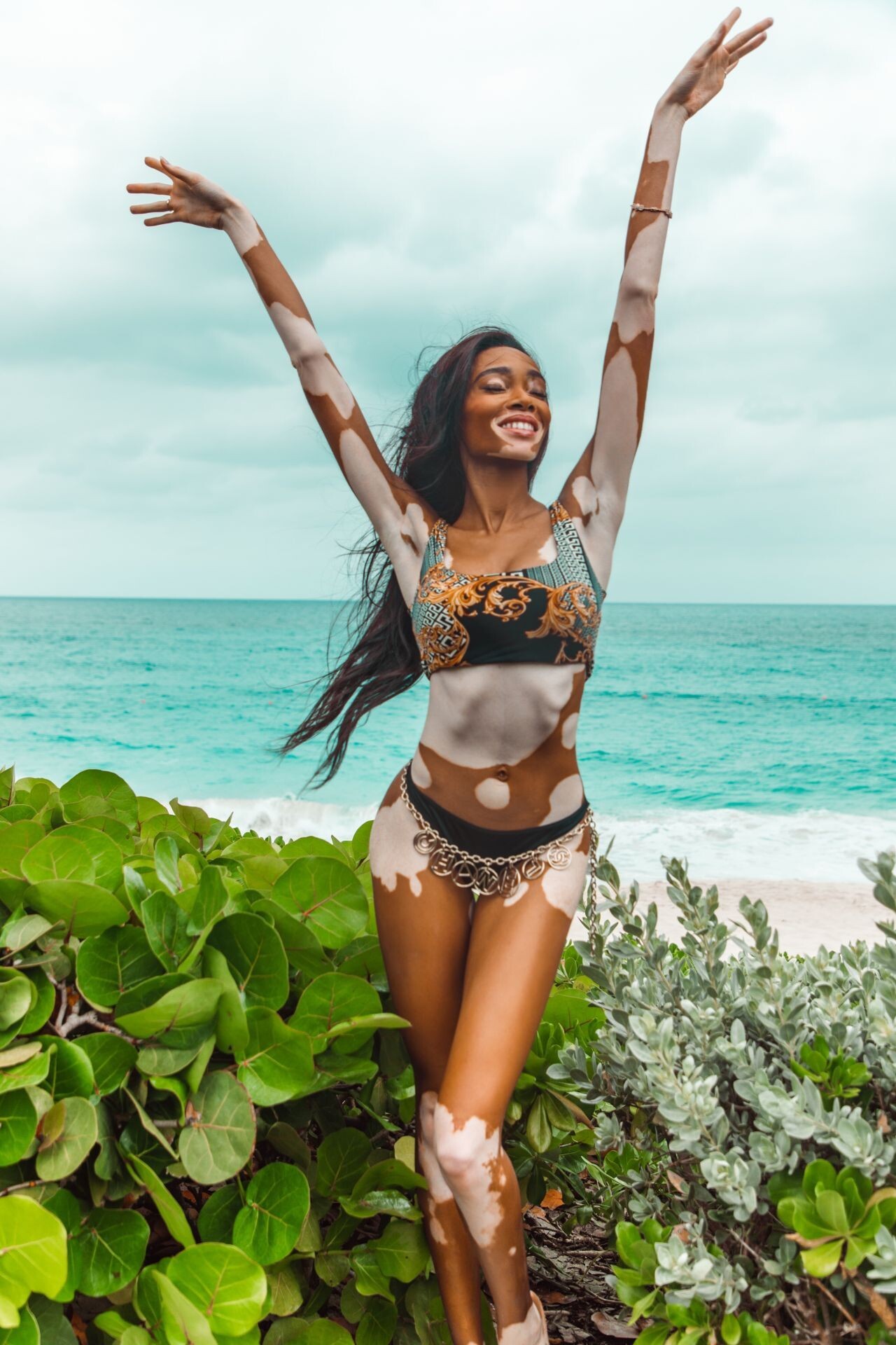 winnie-harlow-topless-sexy-10 winnie harlow topless sexy 10