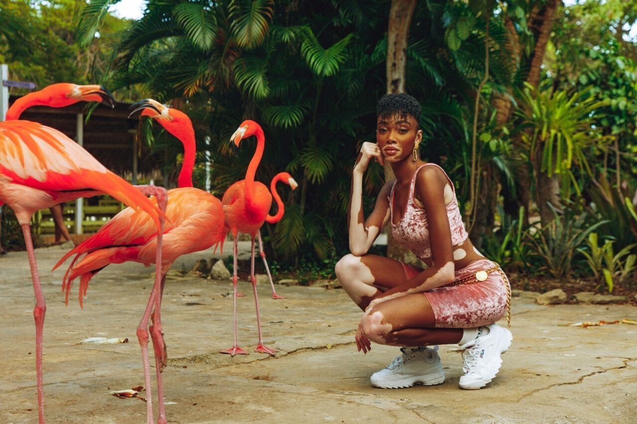 winnie-harlow-topless-sexy-6 winnie harlow topless sexy 6