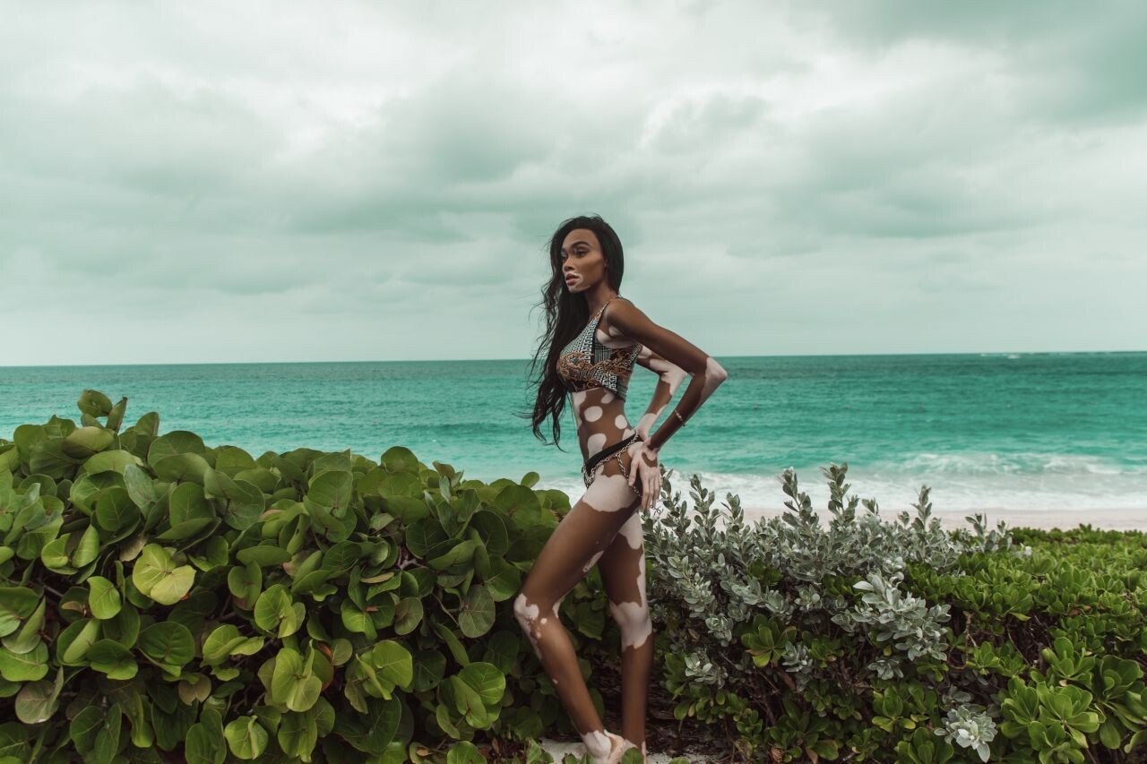 winnie-harlow-topless-sexy-9 winnie harlow topless sexy 9
