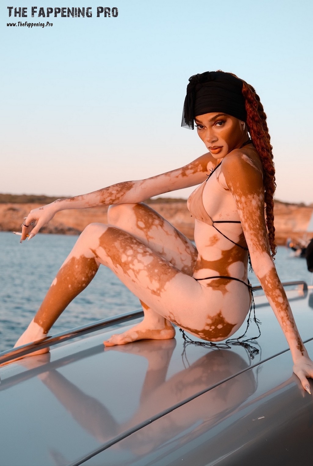 Winnie Harlow Sexy